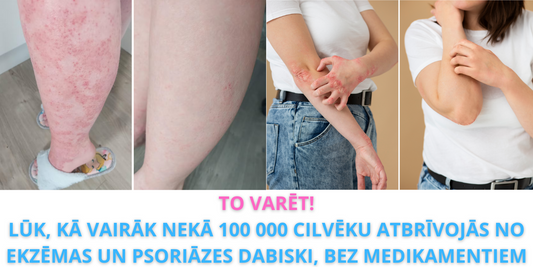 Atvadieties no Ekzēmas 3 Vienkāršos Soļos - ar Dabīgo Ūdeni, par Kuru Runā Visi