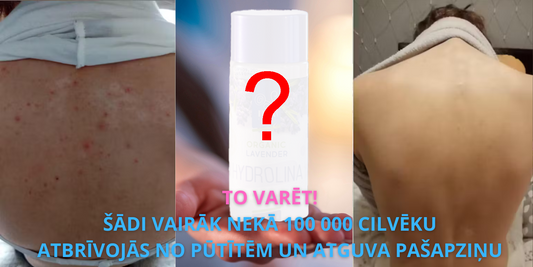Kā Iegūt Skaidru Ādu Bez Medikamentiem 3 Vienkāršos Soļos