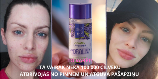 7 VIENKĀRŠTI PASĀKUMI, kā atbrīvoties no pūtītēm BEZ MEDIKamentiem!
