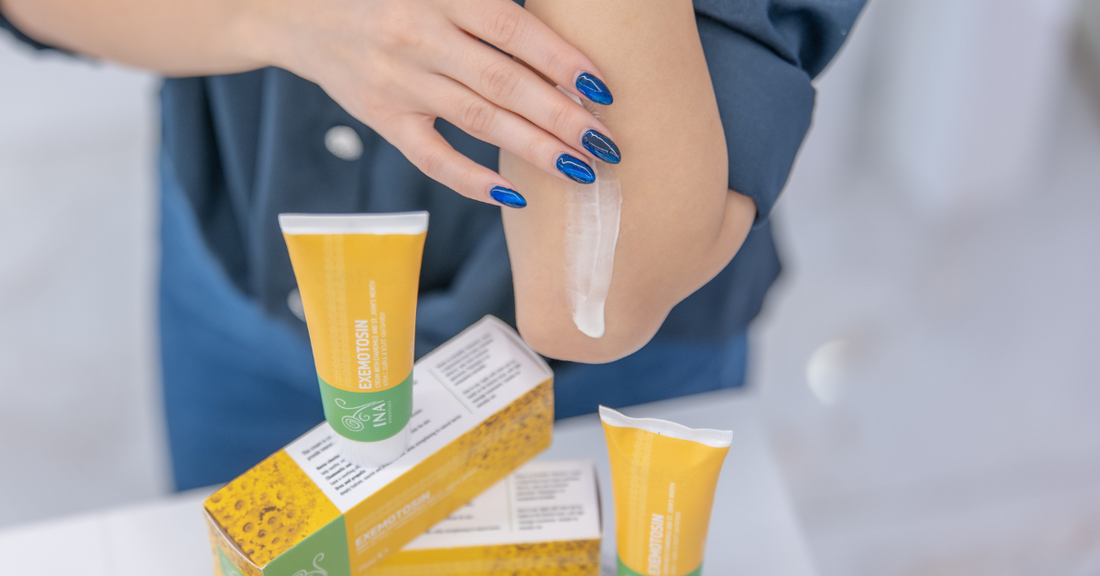 Ekzēma – dabiska ādas kopšana ar InaEssentials