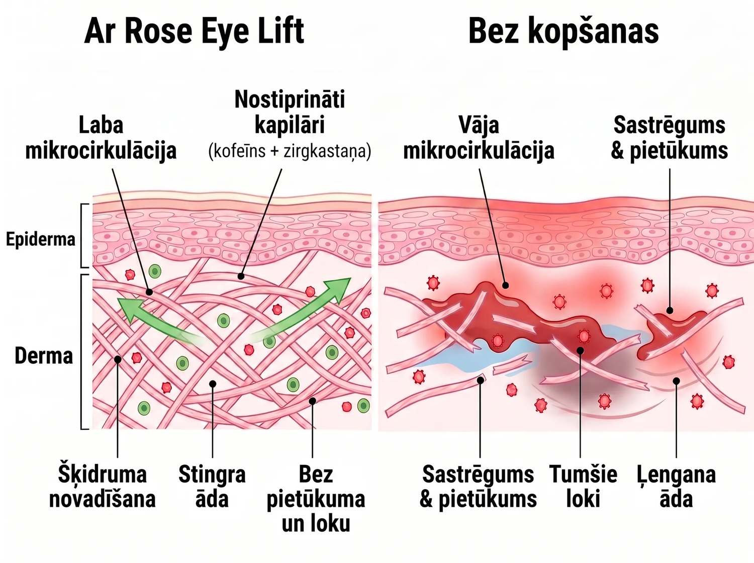 Rose Eye Lift LV t17